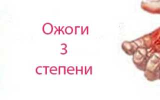 Как долго заживают раны после ожога кипятком