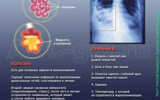 Рентгеновские снимки легких при пневмонии у детей
