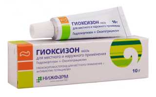 Можно ли мазать ожоги гиоксизоном