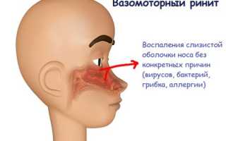 После мне пневмонии появился насморк