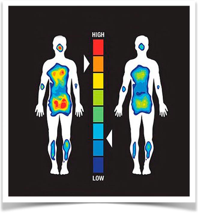 Места на теле где наибольшее давление при сне