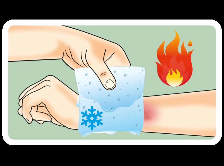 Средства от ожогов