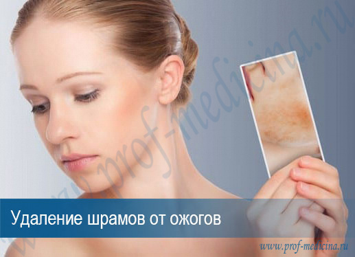 Как убрать следы от ожога лазером