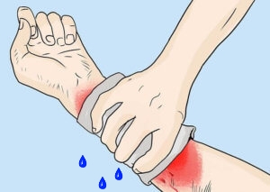 Компресс, смоченный в воде