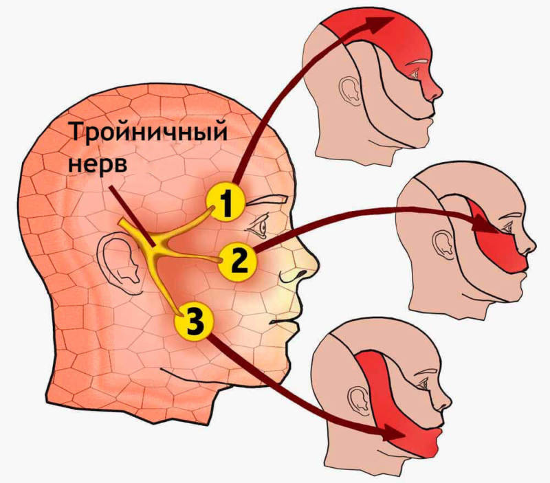 Что такое троичный нерв