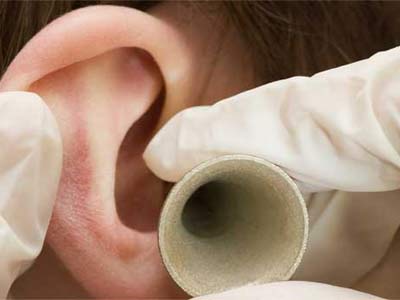 осмотр уха осмотр уха