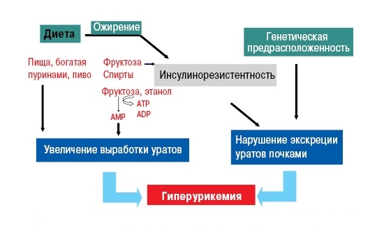 Образование подагры