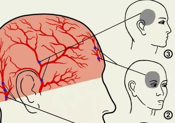 Сильно болит голова за глазом с