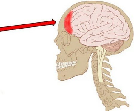 когда голова болит в лобовой части