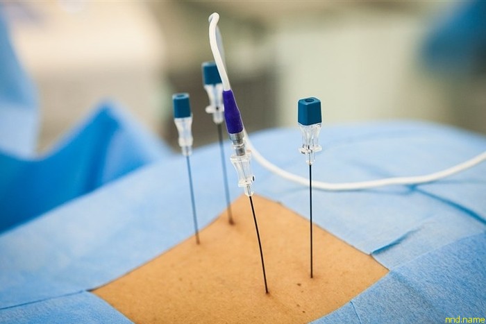 Новые методы лечения болей в спине