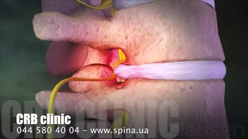 Болит спина в нижней части поясницы что делать