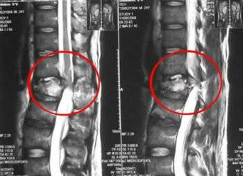 Наклоняешь голову болит спина