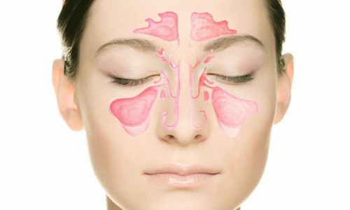 Почему при простудных заболеваниях начинает болеть голова? фото Почему при простудных заболеваниях начинает болеть голова? фото