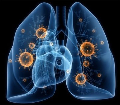 Болит спина слева в районе поясницы у женщин