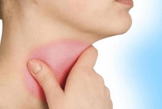 сильно болит горло и голова нет температуры