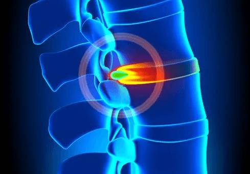 Болит шея голова лопатки