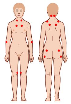 от спины может болеть сердце