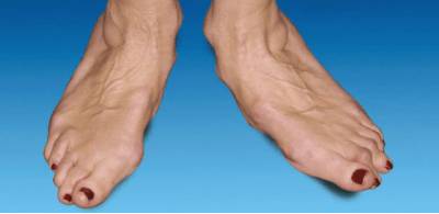 Болит спина суставы стопы