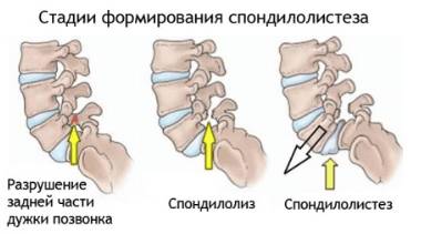почему мышца спины болит ночью