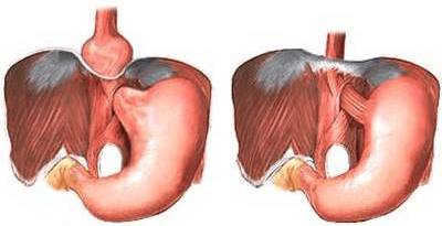 Болит спина слева в районе поясницы у женщин