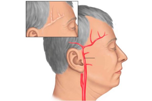Сильно болит голова ничего не помогает