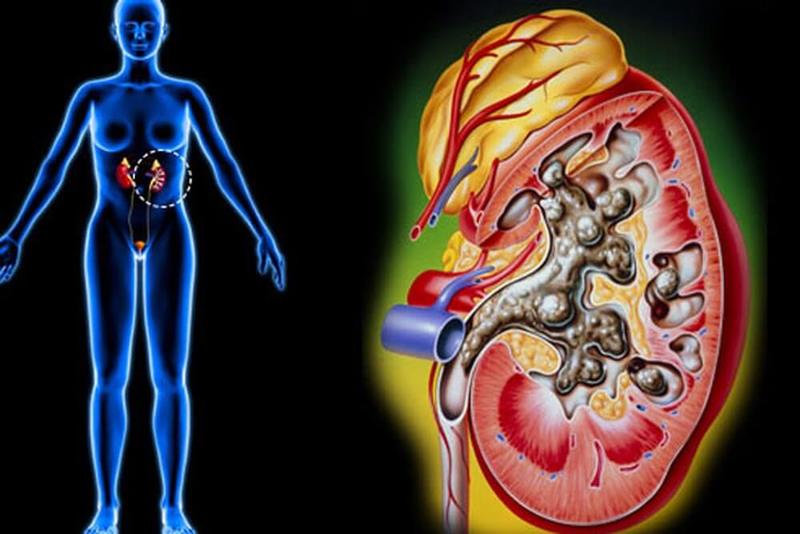 Боль в области таза: 18 возможных причин Боль в области таза: 18 возможных причин