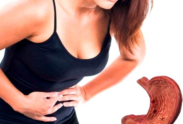 Гастрит может быть причиной болей Гастрит может быть причиной болей