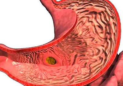 Болит спина слева в районе поясницы у женщин