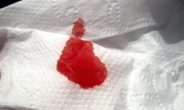 Спина болит и выделение с кровью при беременности