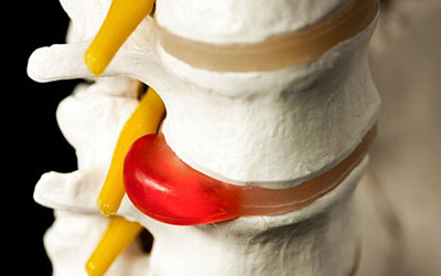 от спины может болеть сердце