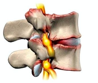 от спины может болеть сердце