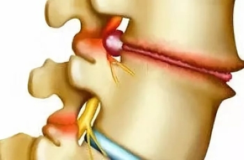 Наклоняешь голову болит спина