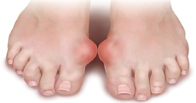 Болит спина суставы стопы