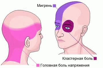 Сильно болит голова ничего не помогает